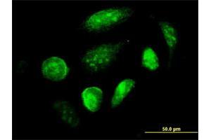 Immunofluorescence of monoclonal antibody to GCM1 on HeLa cell. (GCM1 Antikörper  (AA 108-166))