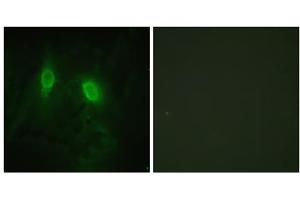 Immunofluorescence analysis of HeLa cells, using IKK- gamma (epitope around residue 85) antibody. (IKBKG Antikörper  (Ser85))