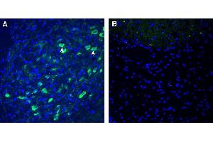 Expression of α2B-Adrenergic Receptor in mouse cerebellar nuclei.