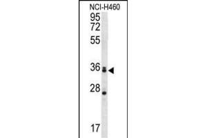 MBNL3 Antibody (Center) (ABIN657004 and ABIN2846185) western blot analysis in NCI- cell line lysates (35 μg/lane). (MBNL3 Antikörper  (AA 251-280))