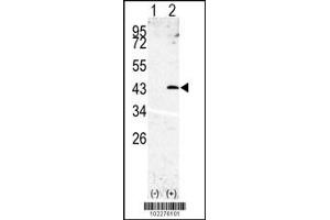 Western blot analysis of SPPL3 using rabbit polyclonal SPPL3 Antibody using 293 cell lysates (2 ug/lane) either nontransfected (Lane 1) or transiently transfected with the SPPL3 gene (Lane 2). (SPPL3 Antikörper  (N-Term))