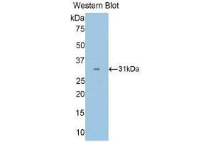 Western Blotting (WB) image for anti-Pyruvate Dehydrogenase beta (PDHB) (AA 65-336) antibody (ABIN1860164) (PDHB Antikörper  (AA 65-336))
