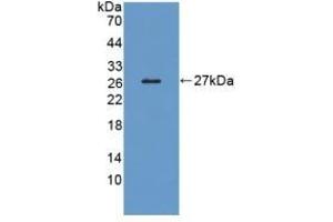 Detection of Recombinant LRP1B, Human using Polyclonal Antibody to Low Density Lipoprotein Receptor Related Protein 1B (LRP1B)
