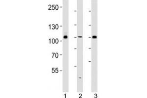 Western blot analysis of lysate from 293, HUVEC, T47D cell line (left to right) using GAB1 antibody diluted at 1:1000 for each lane.
