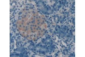 Used in DAB staining on fromalin fixed paraffin- embedded Kidney tissue (POMT1 Antikörper  (AA 318-513))