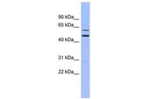 Image no. 1 for anti-Dyskeratosis Congenita 1, Dyskerin (DKC1) (AA 35-84) antibody (ABIN6742970) (DKC1 Antikörper  (AA 35-84))