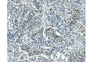 IHC analysis of MSI using anti-MSI antibody (ABIN7603130).