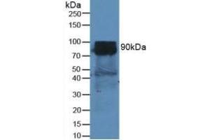 Rabbit Capture antibody from the kit in WB with Positive Control: Sample Mouse Heart Tissue.