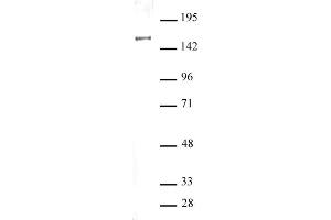 SIN3A antibody (pAb) tested by Western blot. (SIN3A Antikörper  (N-Term))