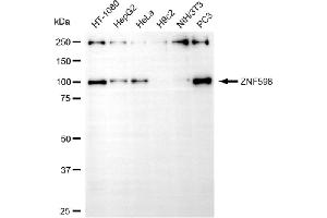 Western blotting analysis using ZNF598 antibody (ABIN7800899). (ZNF598 Antikörper)