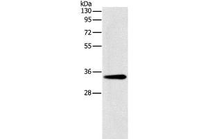 Western Blot analysis of Mouse liver tissue using GNMT Polyclonal Antibody at dilution of 1:200