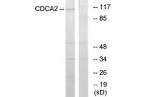 Western blot analysis of extracts from 293 cells, using CDCA2 Antibody. (CDCA2 Antikörper  (AA 511-560))