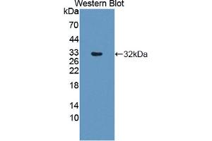 Figure. (DPYD Antikörper  (AA 169-422))