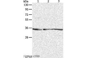 Western blot analysis of NIH/3T3, A431 and Jurkat cell, using RPLP0 Polyclonal Antibody at dilution of 1:750 (RPLP0 Antikörper)