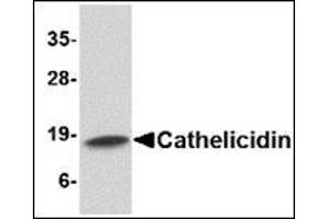 Western blot analysis of Cathelicidin in Human spleen tissue lysate with Cathelicidin antibody at 1 µg/ml.