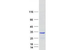 Validation with Western Blot