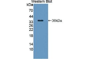 Detection of Recombinant TAK1L, Human using Polyclonal Antibody to TAK1 Like Protein (TAK1L) (MAP3K7CL Antikörper  (AA 1-242))