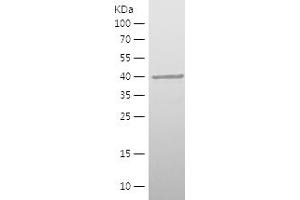 MAP1B Protein (AA 2094-2358) (His tag)