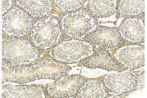 ABIN6261678 and ABIN6268891 at 1/100 staining Rat testis tissue by IHC-P. (FAP Antikörper  (Internal Region))