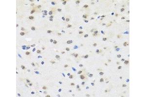 Immunohistochemistry of paraffin-embedded Mouse brain using SAFB2 Polyclonal Antibody at dilution of 1:100 (40x lens). (SAFB2 Antikörper)