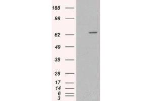 Western Blotting (WB) image for anti-Myotubularin 1 (MTM1) (C-Term) antibody (ABIN2465965) (MTM1 Antikörper  (C-Term))