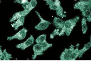 Immunofluoresent staining of ES2 cells with anti-CD105/endoglin antibody. (Endoglin Antikörper  (AA 24-144))