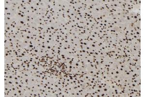 ABIN6272965 at 1/100 staining Mouse liver tissue by IHC-P. (MTA3 Antikörper  (Internal Region))
