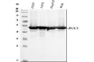 Western blot analysis of RCC1 using anti-RCC1 antibody (ABIN7600022).
