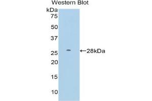 Western blot analysis of the recombinant protein. (FDFT1 Antikörper  (AA 187-416))