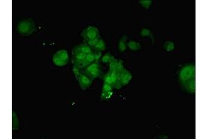 Immunofluorescent analysis of MCF-7 cells using ABIN7161840 at dilution of 1:100 and Alexa Fluor 488-congugated AffiniPure Goat Anti-Rabbit IgG(H+L) (NUP214 Antikörper  (AA 28-238))