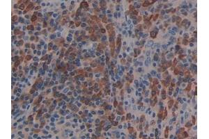 Immunohistochemistry (IHC) image for anti-Linker For Activation of T Cells Family, Member 2 (LAT2) (AA 30-209) antibody (ABIN7439774)