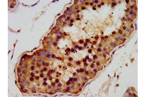 IHC image of ABIN7144009 diluted at 1:200 and staining in paraffin-embedded human testis tissue performed on a Leica BondTM system. (AMMECR1 Antikörper  (AA 146-248))