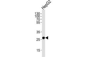 Western Blotting (WB) image for anti-Enoyl-CoA Delta Isomerase 1 (ECI1) antibody (ABIN3003901) (DCI Antikörper)