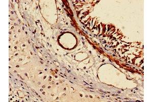 IHC image of ABIN7153823 diluted at 1:150 and staining in paraffin-embedded human lung tissue performed on a Leica BondTM system. (RABGGTA Antikörper  (AA 1-200))