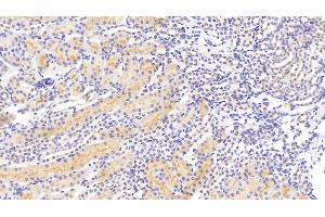 Immunohistochemistry (IHC) image for anti-Receptor Tyrosine Kinase-Like Orphan Receptor 1 (ROR1) (AA 470-707) antibody (ABIN7439633)