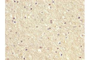 IHC image of ABIN7166949 diluted at 1:200 and staining in paraffin-embedded human brain tissue performed on a Leica BondTM system. (GDI1 Antikörper  (AA 35-170))