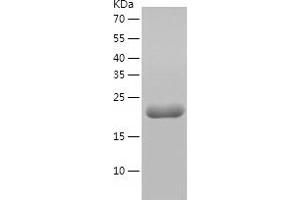 Western Blotting (WB) image for Molybdenum Cofactor Synthesis 2 (MOCS2) (AA 1-188) protein (His tag) (ABIN7124015) (MOCS2 Protein (AA 1-188) (His tag))
