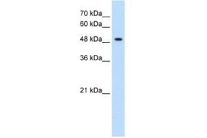 WB Suggested Anti-GLYCTK Antibody Titration:  1. (GLYCTK Antikörper  (N-Term))