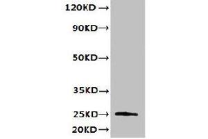 Western blot All lanes: TMED3 antibody at 6 μg/mL + MCF-7 whole cell lysate Secondary Goat polyclonal to rabbit IgG at 1/10000 dilution Predicted band size: 25, 20 kDa Observed band size: 25 kDa (TMED3 Antikörper  (AA 24-180))