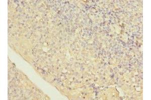 Immunohistochemistry of paraffin-embedded human tonsil tissue using ABIN7158438 at dilution of 1:100 (LITAF Antikörper  (AA 1-161))