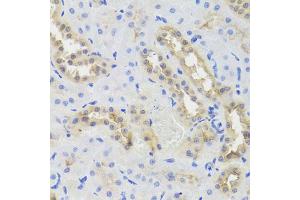 Immunohistochemistry of paraffin-embedded rat kidney using DISC1 antibody (ABIN5971500) at dilution of 1/100 (40x lens). (DISC1 Antikörper)