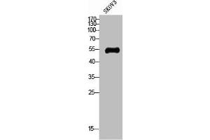 Western Blot analysis of SKOV3 cells using Glut4 Polyclonal Antibody (GLUT4 Antikörper  (N-Term))