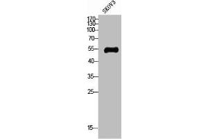 Western Blotting (WB) image for anti-Solute Carrier Family 2 (Facilitated Glucose Transporter), Member 4 (SLC2A4) (N-Term) antibody (ABIN7188776)