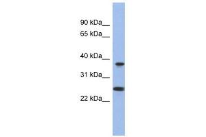 MTRF1L antibody used at 1 ug/ml to detect target protein. (MTRF1L Antikörper  (N-Term))