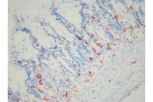 Image no. 3 for anti-Macrophages antibody (ABIN481699) (Macrophages Antikörper)