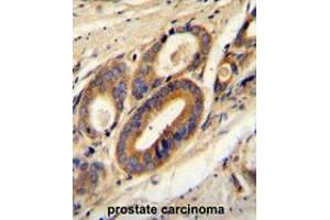 Immunohistochemistry (Paraffin-embedded Sections) (IHC (p)) image for anti-ATPase, H+ Transporting, Lysosomal 21kDa, V0 Subunit B (ATP6V0B) (AA 111-139), (Middle Region) antibody (ABIN950566)
