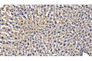 Immunohistochemistry (IHC) image for anti-Toll Interacting Protein (TOLLIP) (AA 19-254) antibody (ABIN7439285)