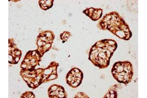 Immunohistochemistry (IHC) image for anti-Casein Kinase 1, epsilon (CSNK1E) (AA 17-231), (Isoform epsilon) antibody (ABIN7146866)
