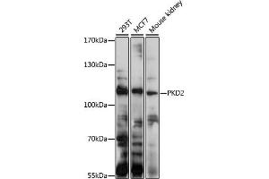 Western blot analysis of extracts of various cell lines, using PKD2 antibody (ABIN1682187, ABIN3017899, ABIN3017900, ABIN5664370 and ABIN6220297) at 1:1000 dilution. (PKD2 Antikörper  (AA 240-410))