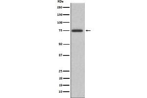 Western blot analysis of ABI2 expression in K562 cell lysate.